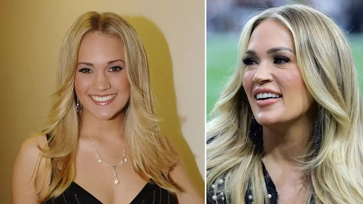 Carrie Underwood’s Changing Appearance and Plastic Surgery Speculations