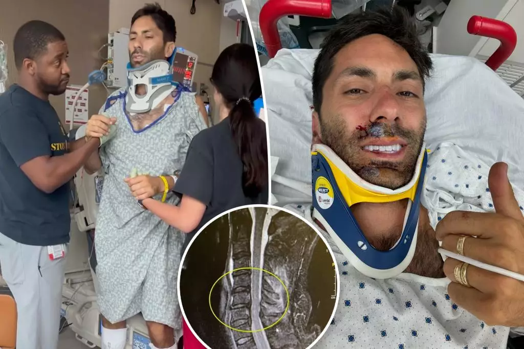 Celebrity Nev Schulman Opens Up About Terrifying Bike Accident