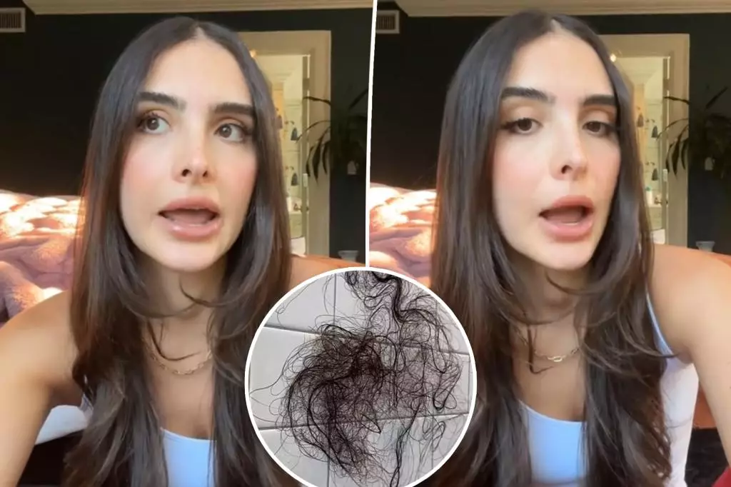 Empowering Truth: Sophia Umansky’s Battle with Hair Loss and Honesty About Weight Loss Medication