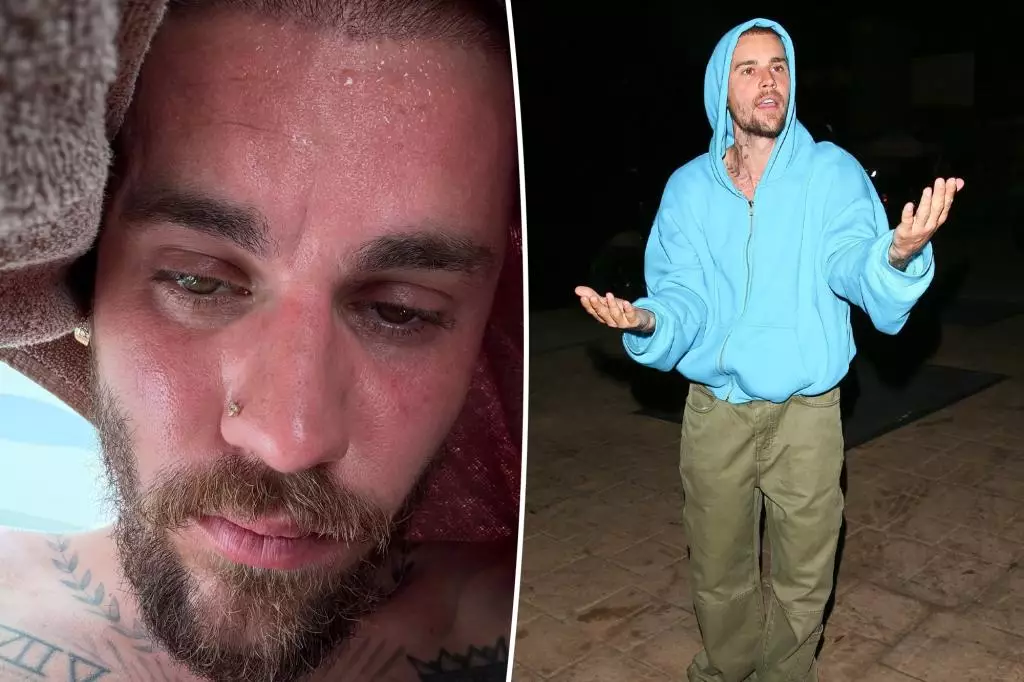 Justin Bieber’s Journey to Redemption: An Ambitious Step Toward Wellness